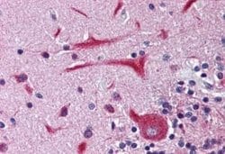 Kv11.1 Antibody, Novus Biologicals 50 &mu;g | Buy Online | Novus Biologicals | Fisher Scientific